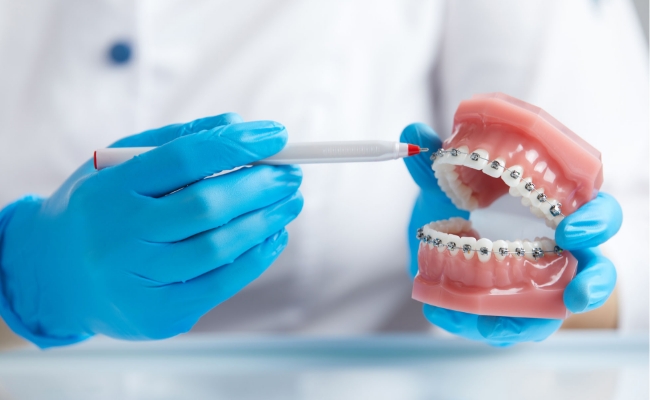 メタルブラケット