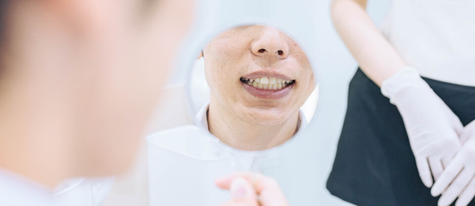 定期的なタッチアップでいつまでも輝く歯を