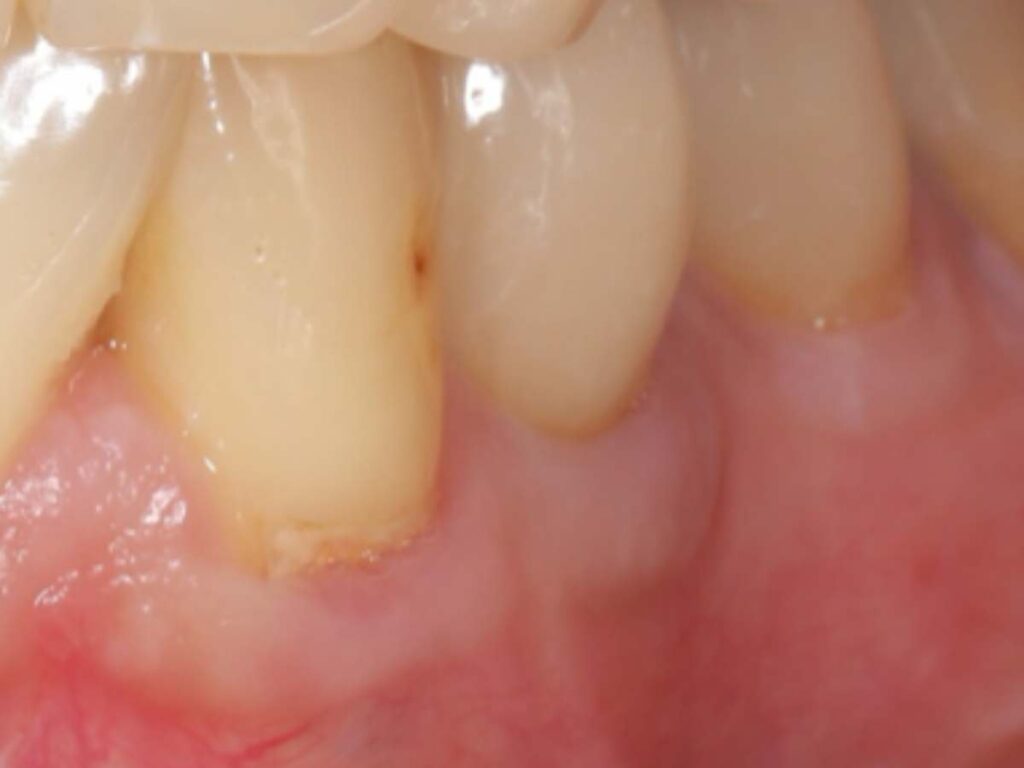 術後正面観(術後10年以上経過)